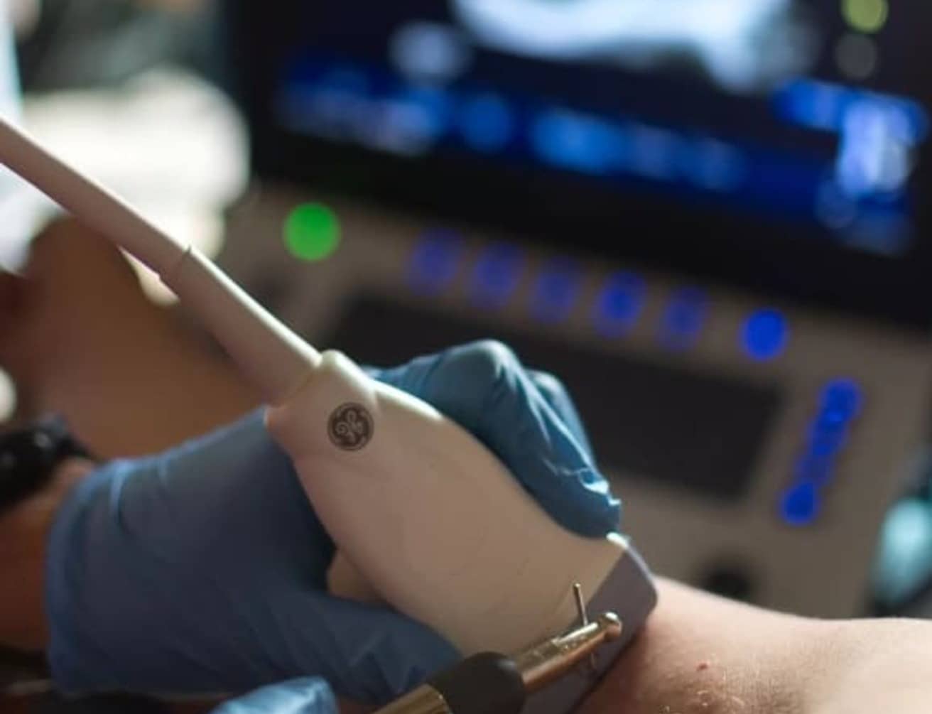 Neuromodulación Percutánea Ecoguiada – Innovación en el Alivio del Dolor